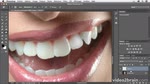 Adobe Photoshop CC : Réparer des dents