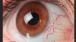 How to Retouch Eyes Using Photoshop CS6 How to Retouch Eyes Using Photoshop CS6